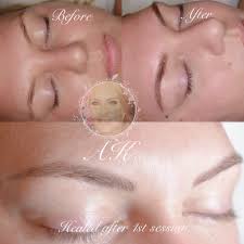 Microblading is semipermanent, meaning it lasts anywhere from six to 36 months, depending on who you ask. Eyebrow Tattooing Vs Microblading What Are The Differences Annette Kemp