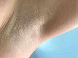 Ipl hair removal for women, permanent laser hair removal 999,900 flashes, at home use painless hair remover on whole body. Does Ipl At Home Work Philips Lumea Review Indiana Jo