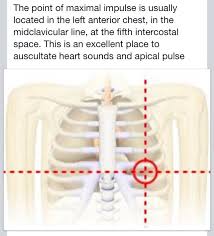 Image result for Point of Maximum Impulse