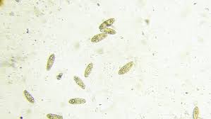 The best type of microscope to use for observation of protozoa is a compound microscope with 3 powers (10x, 40x and 400x). Microscope Image Footage Of Protozoa Microorganisms In Water Showing Ciliates Paramecium Bacteria Spirochaete And Algae