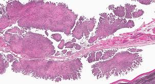 Conference 17 2016 Case 4 20170201