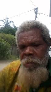 Image result for Helinus spartioides