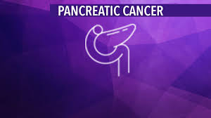 Pain in the abdomen (belly) or back is common in pancreatic cancer. Treatment Of Stage Iv Metastatic Pancreatic Cancer Cancerconnect