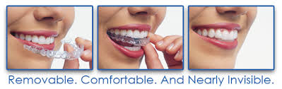 If your teeth aren't currently. Invisalign Straighten Teeth Without Braces Drummoyne Dental Practice