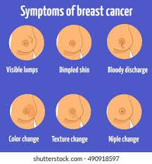 Skin changes skin changes are actually one of the most common lesser known signs of breast cancer. Breast Cancer Symptoms Vector Illustration Stock Vector Royalty Free 490918597