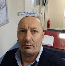 This bloke won't be going out in public ….