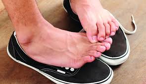 Apply tea tree oil to relieve the infection. How To Get Rid Of A Ringworm At Home Learn How To