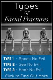 Types Of Facial Skull Fractures Made Easy Le Fort Classification Skeletal System Medical Notes In 2020 Types Of Facials How To Find Out Fractures
