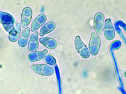 Image result for Erythrococca trichogyne