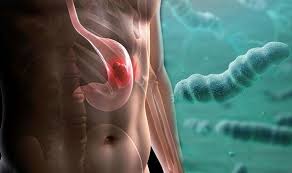 The stages of stomach cancer are indicated by roman numerals that range from 0 to iv, with the lowest stages indicating that the cancer is small and affects only the inner layers of your stomach. Stomach Cancer Symptoms Experiencing These Five Symptoms Could Be A Warning Express Co Uk