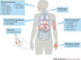 As beautiful as recessed lights are inside, most people don't realize how much of a difference recessed lighting can make outside. New Tools For Diagnosis And Therapy Nature Reviews Rheumatology
