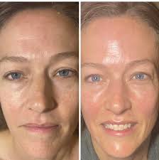 Bloom Esthetic SkinCare by Sara Kim by Sara Kim