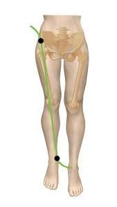 Image result for Functional Leg Length Discrepancy