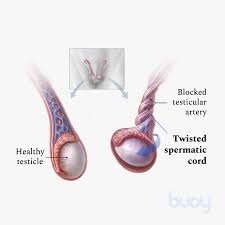 Most cancer screening is specific to certain age groups and your primary care doctor will know what screening cancer gives most people no symptoms or signs that exclusively indicate the disease. Testicular Torsion Symptoms Diagnosis And Treatments