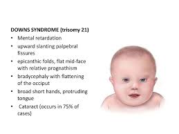 Dr Ezelagbo Anako Mbbs Fwacp Fmcfm 12th June Ppt Video Online Download