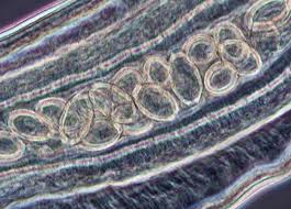 We did not find results for: Whipworms Trichuris Nikon S Microscopyu