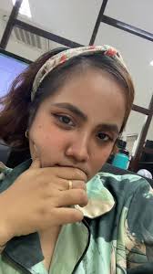 Magpapaskong may bangas sa mukha 🤣