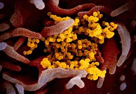 2019 novel coronavirus, wuhan seafood market pneumonia virus) — оболочечный одноцепочный. Niaid Makes New Images Of Sars Cov 2 Available For Covid 19 Coverage Global Biodefense