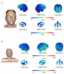 Frontiers Comparison Of The Long Term Effect Of