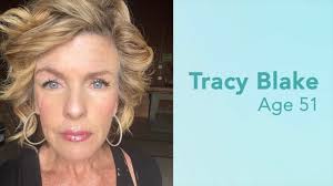 Rejuran® ADVANCED Pigment Corrector Testimonial