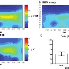 Comparisons Of Frequency Bands Between Sleep Stages A