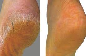 Saglik Guzellik Panosundaki Pin