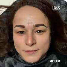 IRIS Richardson Brows