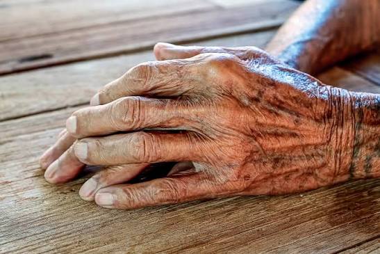 Aging Skin | Sunlight | MedlinePlus