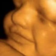 Saptamana 24 De Sarcina