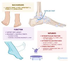Image result for Calcaneus