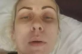 Mum of Scots boy with rare muscle wasting condition knew something was  wrong when he couldn't jump as tot