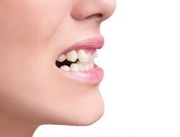 Then they can confidently smile whenever the mood strikes them and know that they look great. Why You Should Choose An Out Of Network Dentist La Mesa Dentist