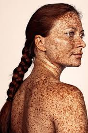 Maybe you would like to learn more about one of these? Freckles Photographer Shines Spotlight On The Beauty Of Spots