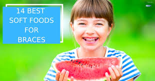 Your dentist or orthodontist will discuss what foods to avoid. 14 Best Soft Foods For Braces Prosmiles Orthodontics