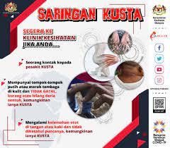 Check spelling or type a new query. Kenyataan Akhbar Kpk 31 Januari 2021 Sambutan Hari Kusta Sedunia 2021 Bersama Hentikan Kusta From The Desk Of The Director General Of Health Malaysia