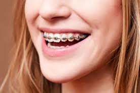 Before you get your braces talk to your dentist about the retainer and how long he expects you to wear it for. Why You Should Wear Your Retainer After Braces Lone Star Pediatric Dental