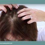 زراعة الشعر للنساء وأسباب تساقط الشعرلماذا تعتبر زراعة الشعر للنساء مهمة وضرورية يمكننا القول أن الشعر أهم عناصر جمال المرأة وأي تغيير في الشعر قد يؤثر سلبا ع
