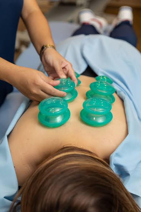 Cupping Therapy in Dubai | Franklin Chiropractic