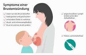 Brustentzundung Mastitis Ursachen Symptome Behandlung