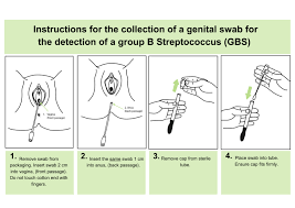 Image result for Group B Streptococcus Prophylaxis