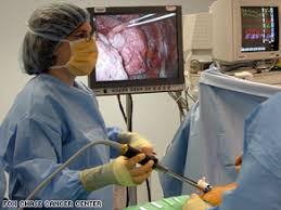 New Technique Reduces Trauma Of Lung Surgery Cnn Com