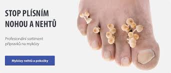 Image result for mykoza nehtů