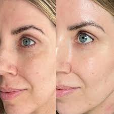 ✨ Have You Tried Revival...