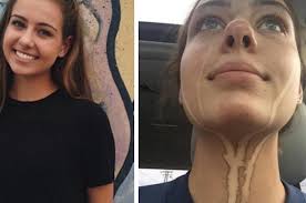 This 17-Year-Old Learned The Hard Way Not To Cry After Getting A Spray Tan