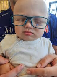 Today was longer than expected but worth the time. We started with the  check of the stitch. Looks great, no bandage required anymore. His white  blood cells and a few numbers were