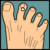 Maybe you would like to learn more about one of these? Toothache Acupressure Pointfinder Mobile Enabled