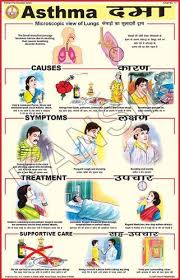 But in some visualizations, the size. Natural Color Laminated Paper Asthma For Prevent Diseases Chart Size 50x75 Rs 96 Piece Id 2894418412
