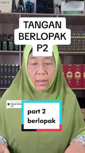 Replying to @nimsnawi menjawab soalan diatas yaa😁 #fyp #stress #tangan  #sihat #kakaidasubangjaya #pening #gula