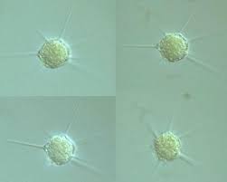 Image result for Raphidiocystis
