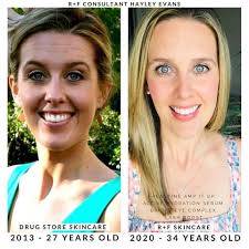 This is the most amazing transformation I've seen yet. She uses the  Anti-aging skin care set and added in the the Bakuchiol serum. What a  difference in only 6 months WOW 🤯